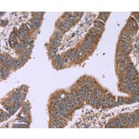 Immunohistochemistry - IFNA2 Antibody from Signalway Antibody (37642) - Antibodies.com