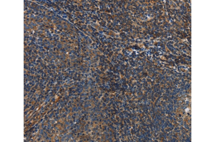 Immunohistochemistry - IL17D Antibody from Signalway Antibody (37647) - Antibodies.com