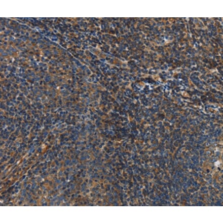 Immunohistochemistry - IL17D Antibody from Signalway Antibody (37647) - Antibodies.com