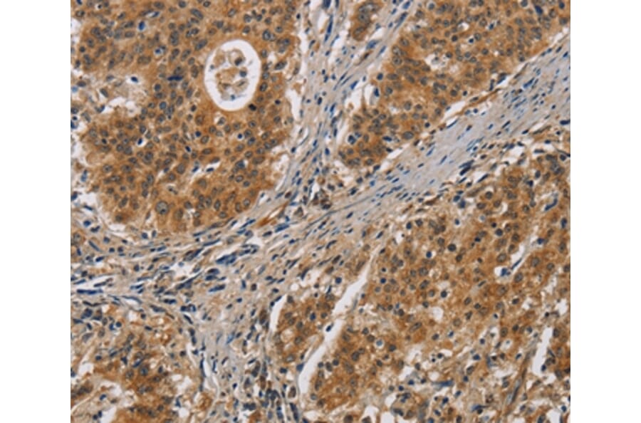 Immunohistochemistry - IL17D Antibody from Signalway Antibody (37647) - Antibodies.com