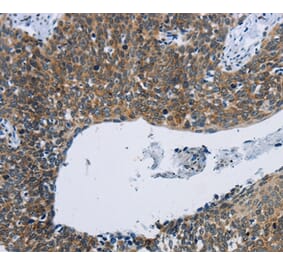 Immunohistochemistry - KPNB1 Antibody from Signalway Antibody (37656) - Antibodies.com