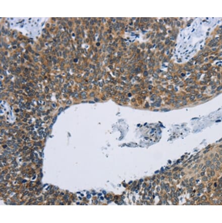 Immunohistochemistry - KPNB1 Antibody from Signalway Antibody (37656) - Antibodies.com