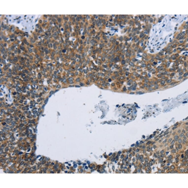 Immunohistochemistry - KPNB1 Antibody from Signalway Antibody (37656) - Antibodies.com