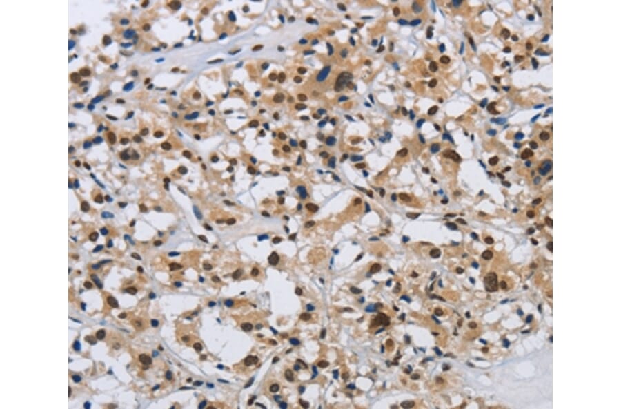 Immunohistochemistry - KPNB1 Antibody from Signalway Antibody (37656) - Antibodies.com