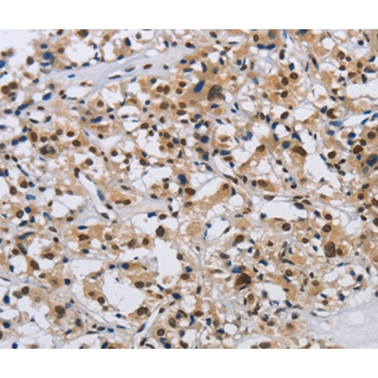 Immunohistochemistry - KPNB1 Antibody from Signalway Antibody (37656) - Antibodies.com