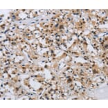 Immunohistochemistry - KPNB1 Antibody from Signalway Antibody (37656) - Antibodies.com