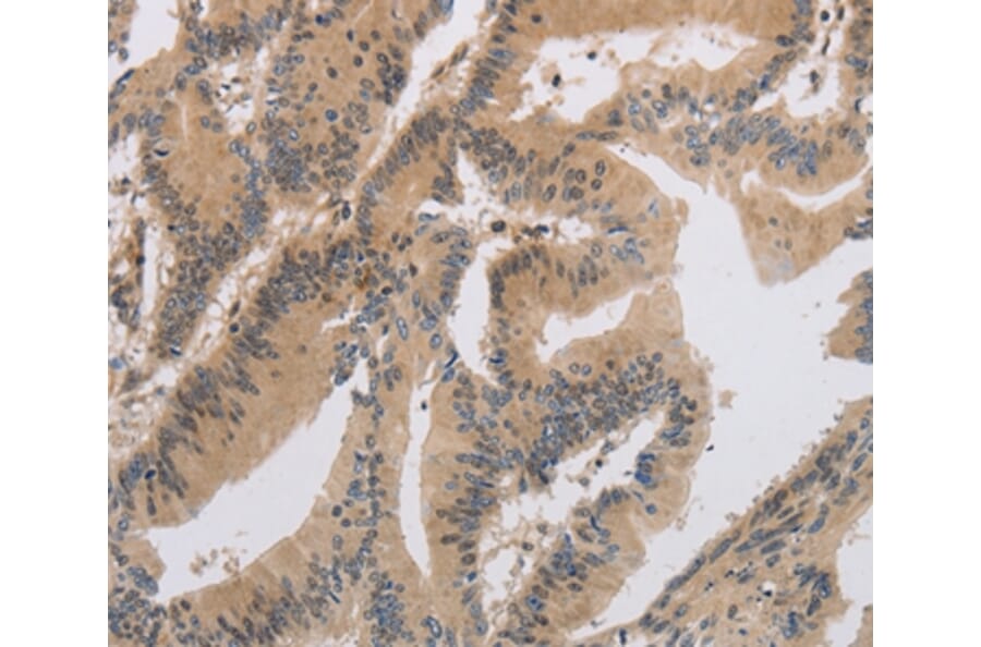 Immunohistochemistry - ITIH1 Antibody from Signalway Antibody (37664) - Antibodies.com