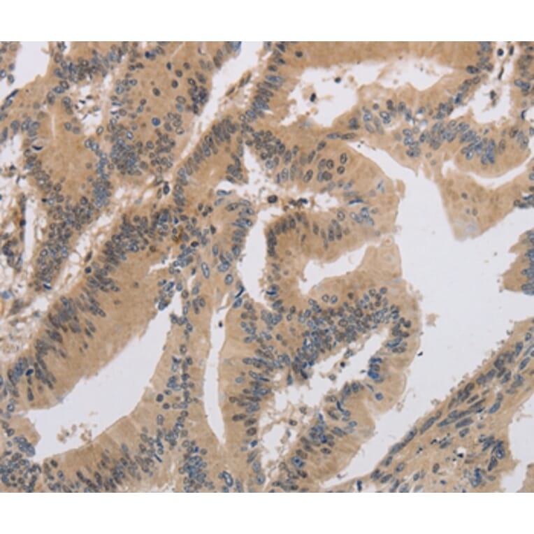 Immunohistochemistry - ITIH1 Antibody from Signalway Antibody (37664) - Antibodies.com