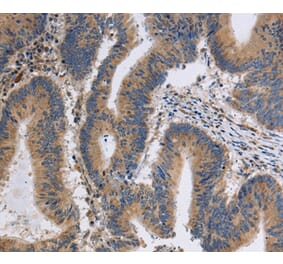 Immunohistochemistry - ITPR1 Antibody from Signalway Antibody (37665) - Antibodies.com