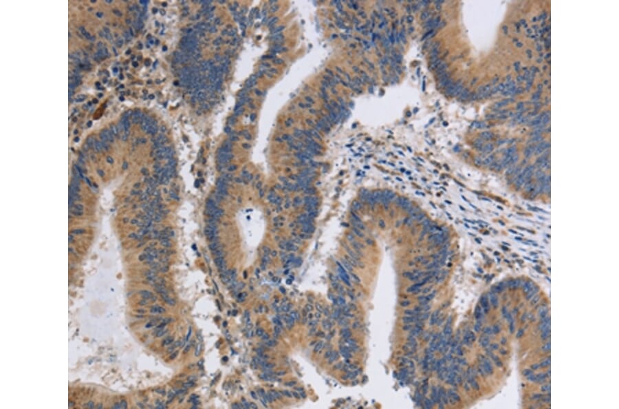 Immunohistochemistry - ITPR1 Antibody from Signalway Antibody (37665) - Antibodies.com