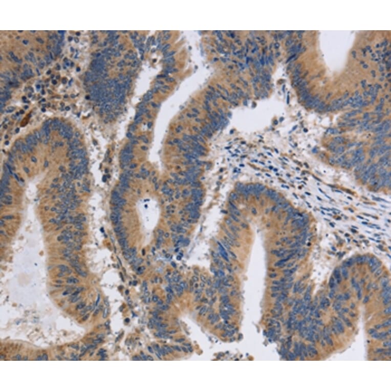 Immunohistochemistry - ITPR1 Antibody from Signalway Antibody (37665) - Antibodies.com
