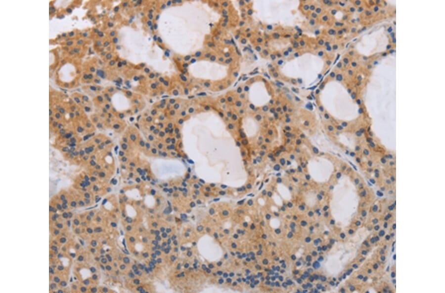 Immunohistochemistry - ITPR1 Antibody from Signalway Antibody (37665) - Antibodies.com