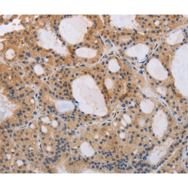 Immunohistochemistry - ITPR1 Antibody from Signalway Antibody (37665) - Antibodies.com