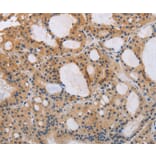 Immunohistochemistry - ITPR1 Antibody from Signalway Antibody (37665) - Antibodies.com