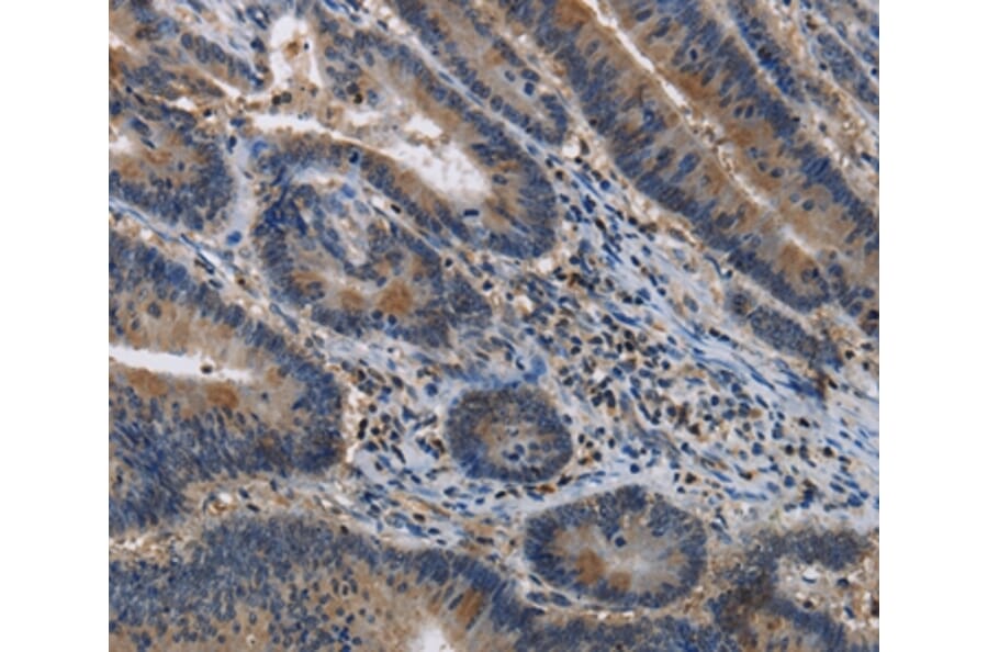 Immunohistochemistry - ITPR2 Antibody from Signalway Antibody (37666) - Antibodies.com