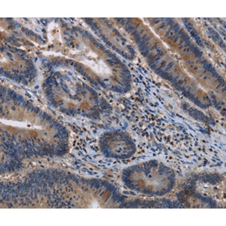 Immunohistochemistry - ITPR2 Antibody from Signalway Antibody (37666) - Antibodies.com