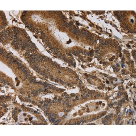 Immunohistochemistry - ITPR3 Antibody from Signalway Antibody (37667) - Antibodies.com