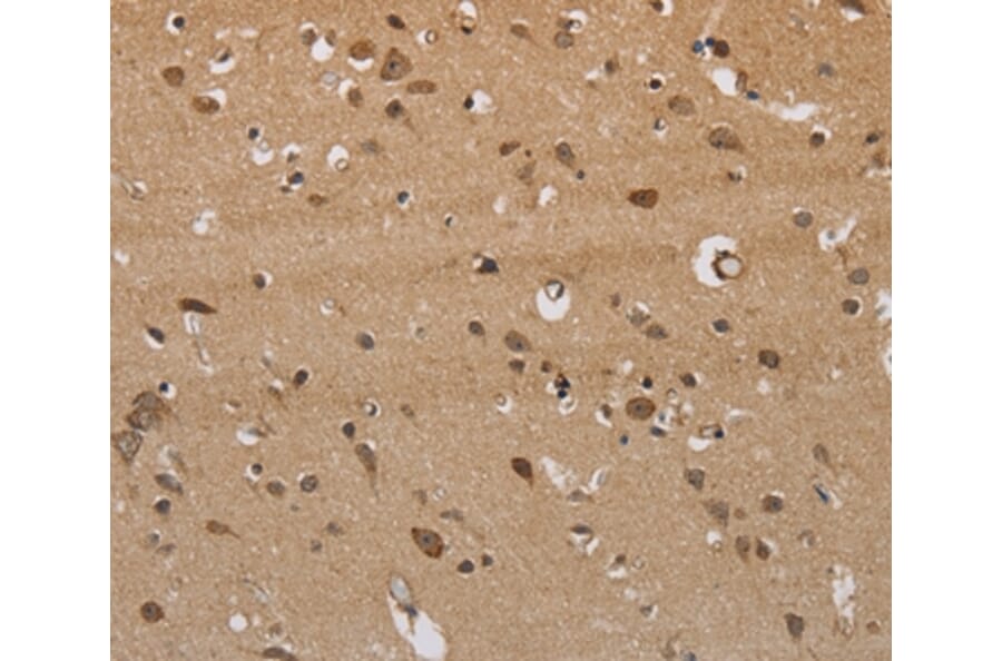 Immunohistochemistry - ITPR3 Antibody from Signalway Antibody (37667) - Antibodies.com