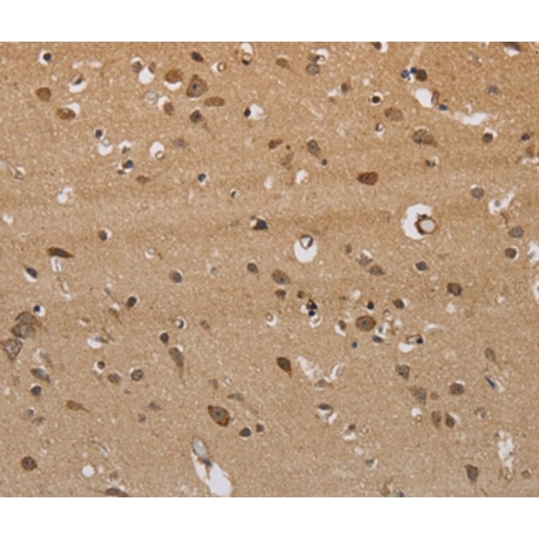 Immunohistochemistry - ITPR3 Antibody from Signalway Antibody (37667) - Antibodies.com
