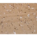 Immunohistochemistry - ITPR3 Antibody from Signalway Antibody (37667) - Antibodies.com