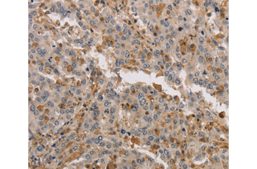 Immunohistochemistry - KIF17 Antibody from Signalway Antibody (37683) - Antibodies.com