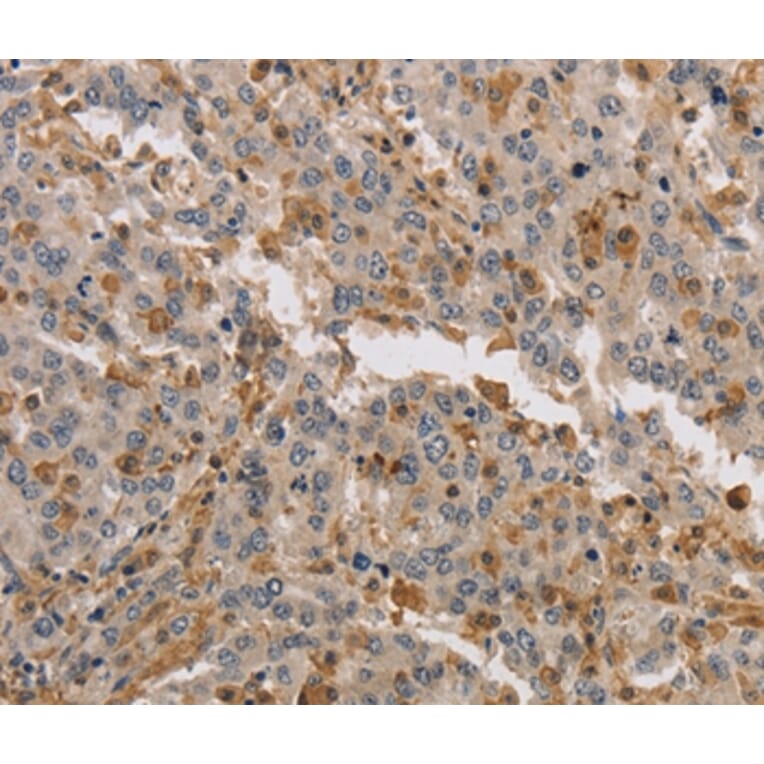 Immunohistochemistry - KIF17 Antibody from Signalway Antibody (37683) - Antibodies.com
