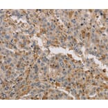 Immunohistochemistry - KIF17 Antibody from Signalway Antibody (37683) - Antibodies.com