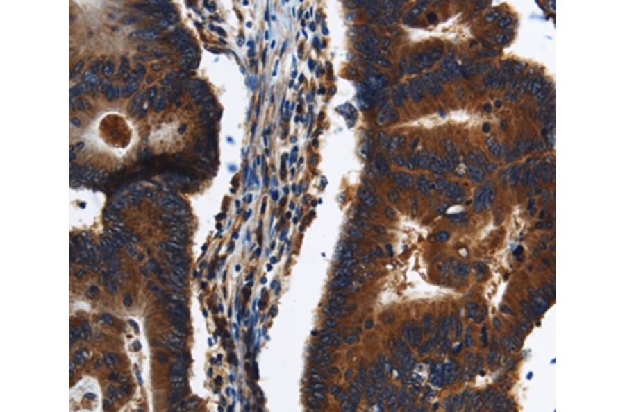 Immunohistochemistry - KLHL8 Antibody from Signalway Antibody (37687) - Antibodies.com
