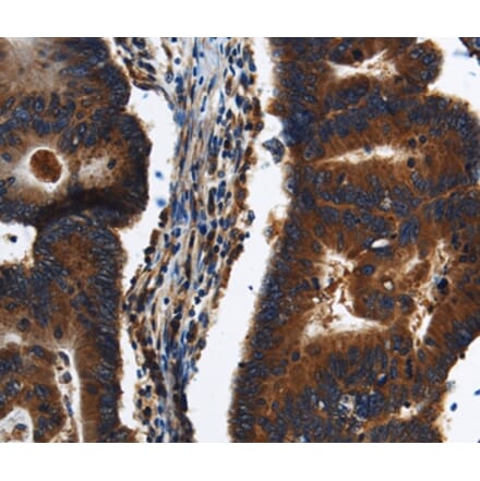 Immunohistochemistry - KLHL8 Antibody from Signalway Antibody (37687) - Antibodies.com