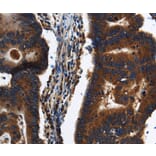 Immunohistochemistry - KLHL8 Antibody from Signalway Antibody (37687) - Antibodies.com