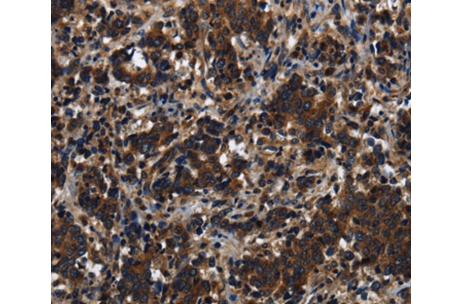 Immunohistochemistry - KLHL8 Antibody from Signalway Antibody (37687) - Antibodies.com