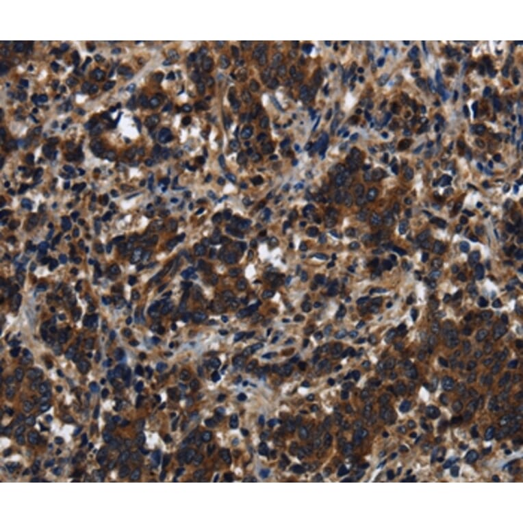 Immunohistochemistry - KLHL8 Antibody from Signalway Antibody (37687) - Antibodies.com