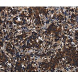 Immunohistochemistry - KLHL8 Antibody from Signalway Antibody (37687) - Antibodies.com