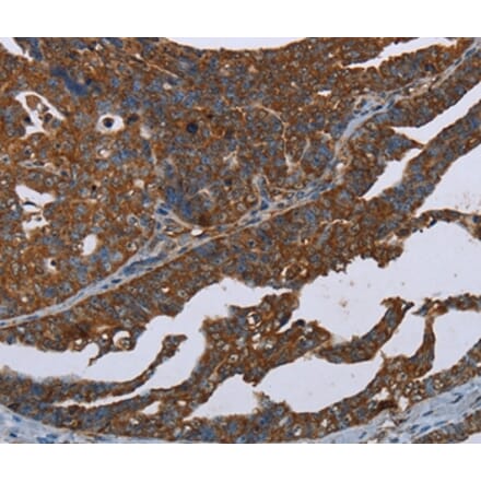 Immunohistochemistry - CERS1 Antibody from Signalway Antibody (37695) - Antibodies.com