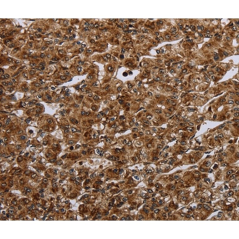 Immunohistochemistry - CERS1 Antibody from Signalway Antibody (37695) - Antibodies.com
