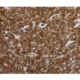Immunohistochemistry - CERS1 Antibody from Signalway Antibody (37695) - Antibodies.com