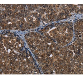 Immunohistochemistry - CERS6 Antibody from Signalway Antibody (37698) - Antibodies.com