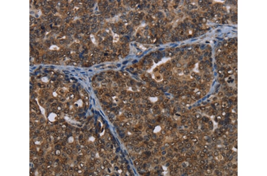 Immunohistochemistry - CERS6 Antibody from Signalway Antibody (37698) - Antibodies.com