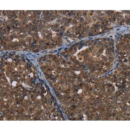 Immunohistochemistry - CERS6 Antibody from Signalway Antibody (37698) - Antibodies.com