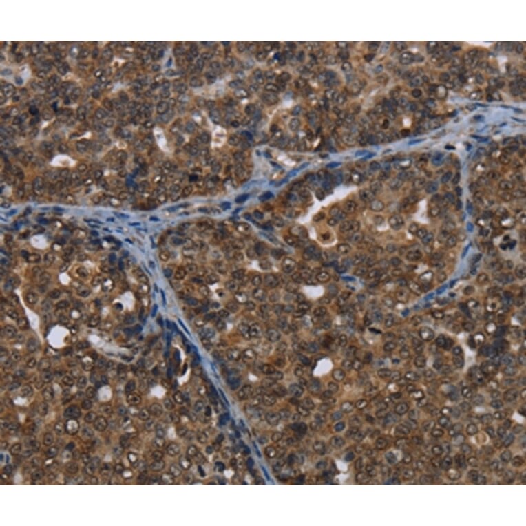 Immunohistochemistry - CERS6 Antibody from Signalway Antibody (37698) - Antibodies.com