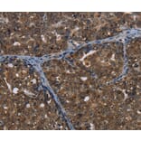 Immunohistochemistry - CERS6 Antibody from Signalway Antibody (37698) - Antibodies.com