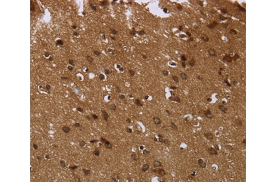 Immunohistochemistry - CERS6 Antibody from Signalway Antibody (37698) - Antibodies.com