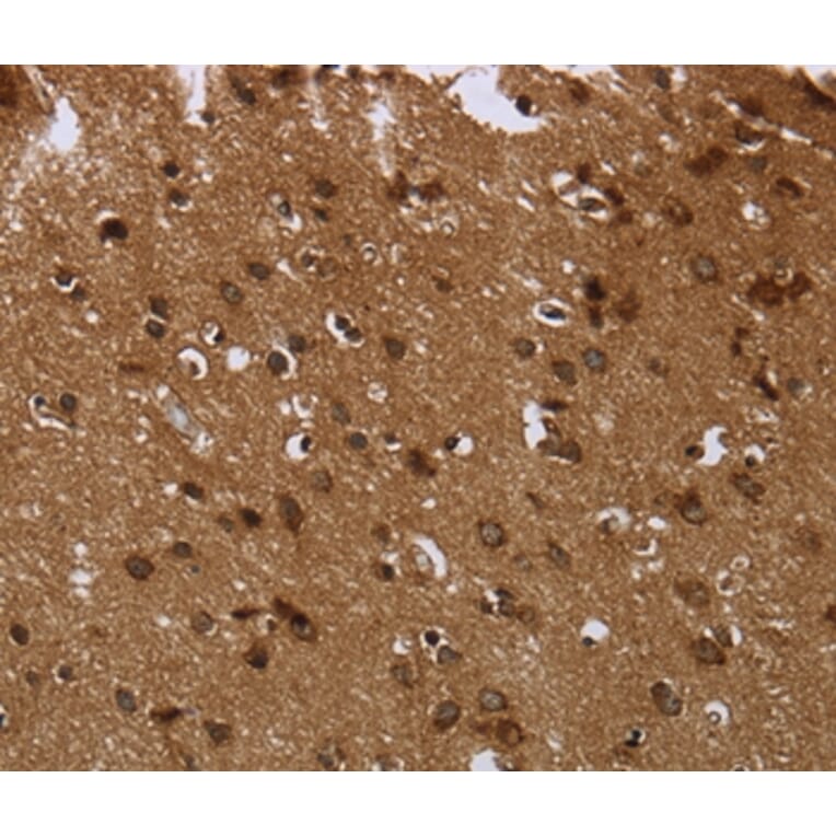 Immunohistochemistry - CERS6 Antibody from Signalway Antibody (37698) - Antibodies.com
