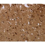 Immunohistochemistry - CERS6 Antibody from Signalway Antibody (37698) - Antibodies.com
