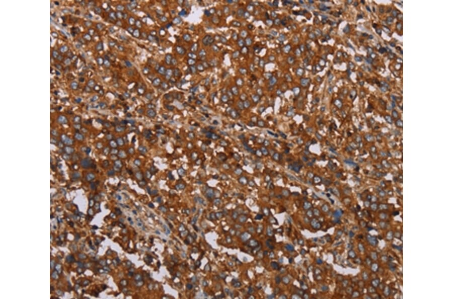 Immunohistochemistry - MFAP5 Antibody from Signalway Antibody (37713) - Antibodies.com