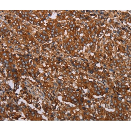 Immunohistochemistry - MFAP5 Antibody from Signalway Antibody (37713) - Antibodies.com