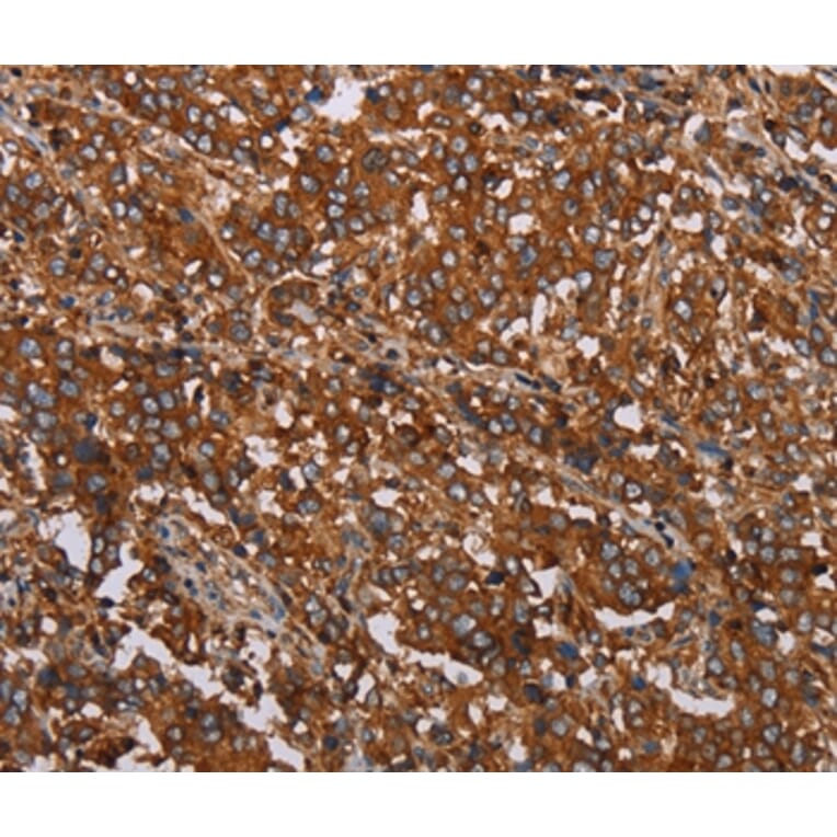 Immunohistochemistry - MFAP5 Antibody from Signalway Antibody (37713) - Antibodies.com