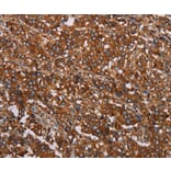 Immunohistochemistry - MFAP5 Antibody from Signalway Antibody (37713) - Antibodies.com