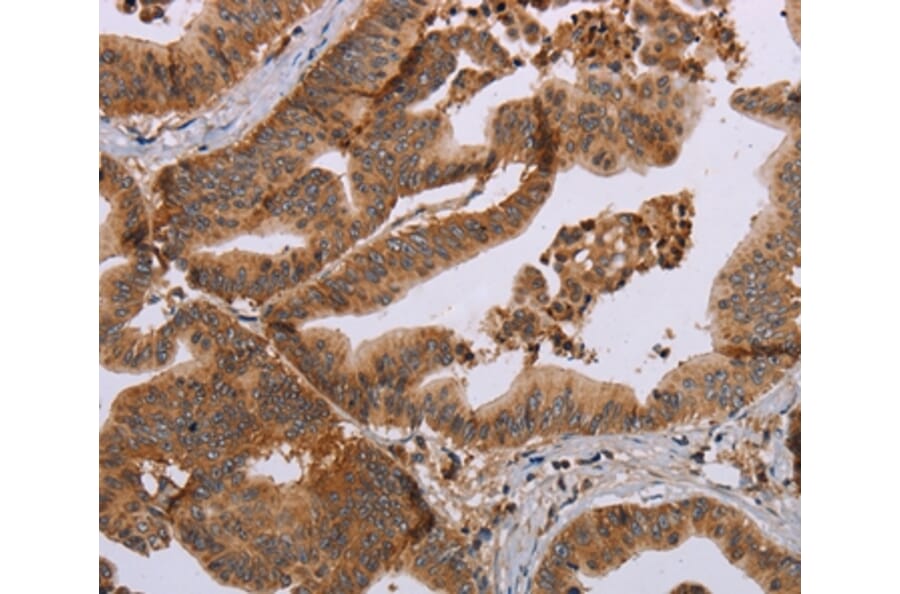 Immunohistochemistry - MFAP5 Antibody from Signalway Antibody (37713) - Antibodies.com