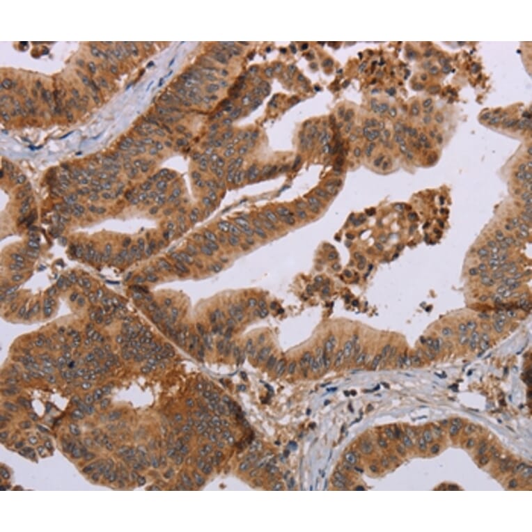 Immunohistochemistry - MFAP5 Antibody from Signalway Antibody (37713) - Antibodies.com